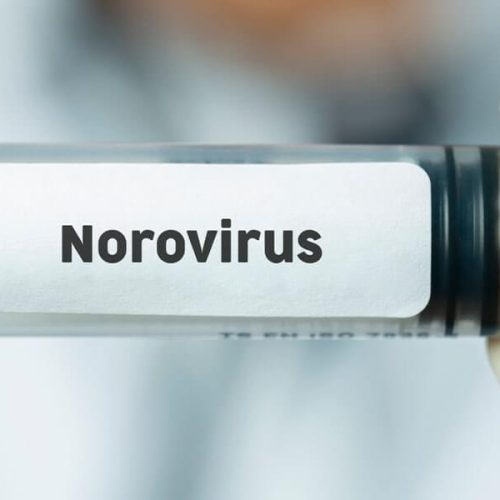 LuxuryCare Supports Groundbreaking Norovirus mRNA Vaccine Trial to Safeguard Residents and Staff